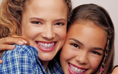 Guía para sobrevivir a las vacaciones con ortodoncia