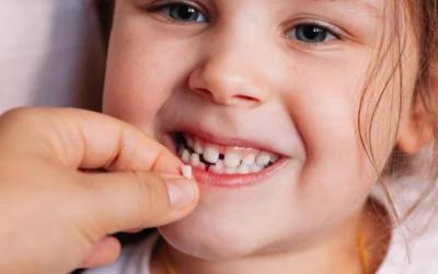 Caída de los dientes de leche