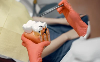 Las caries… ¿qué son y por qué salen?