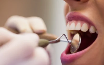 Curetaje: Qué es, beneficios y diferencias con una limpieza al uso