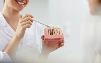 Implantes dentales