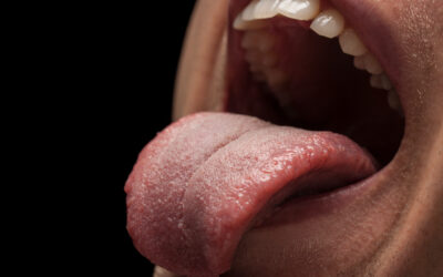 Tu lengua puede hablar de tu estado de salud