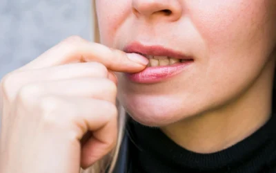 Onicofagia, un hábito que no solo estropea las manos, sino también la boca