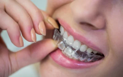 Cómo mantener los dientes alineados tras la ortodoncia