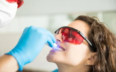 Peligros del blanqueamiento dental en casa