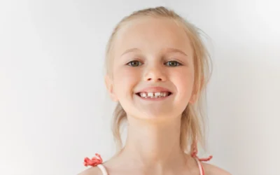 ¿Cuándo es necesario que te hagas un sellado dental?